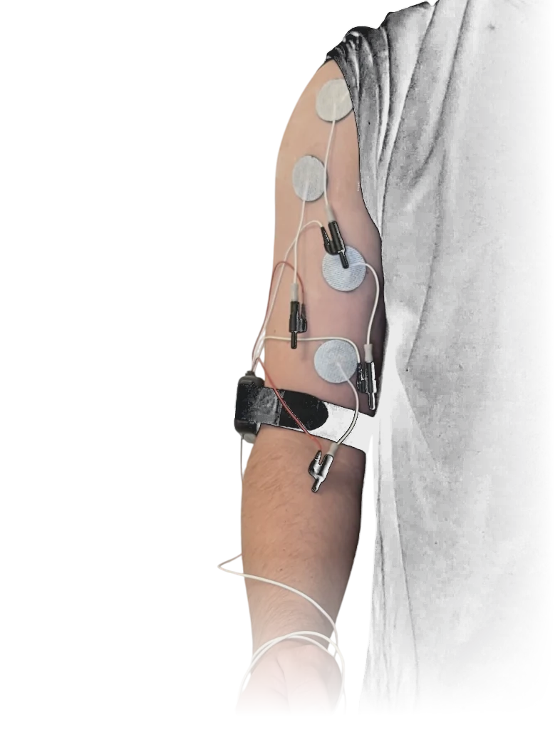 An arm wired with surface electrodes, the cables running down to the hand